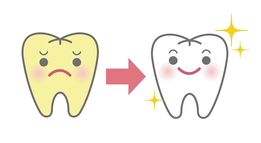 ホワイトニングの内容